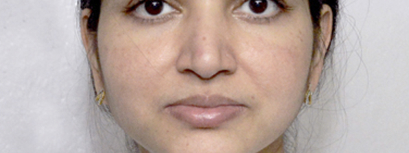 Urging People to Pledge Your Eyes, for Eye Donation
